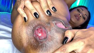 flexi skinny milf prolapse her anus for rough fucking